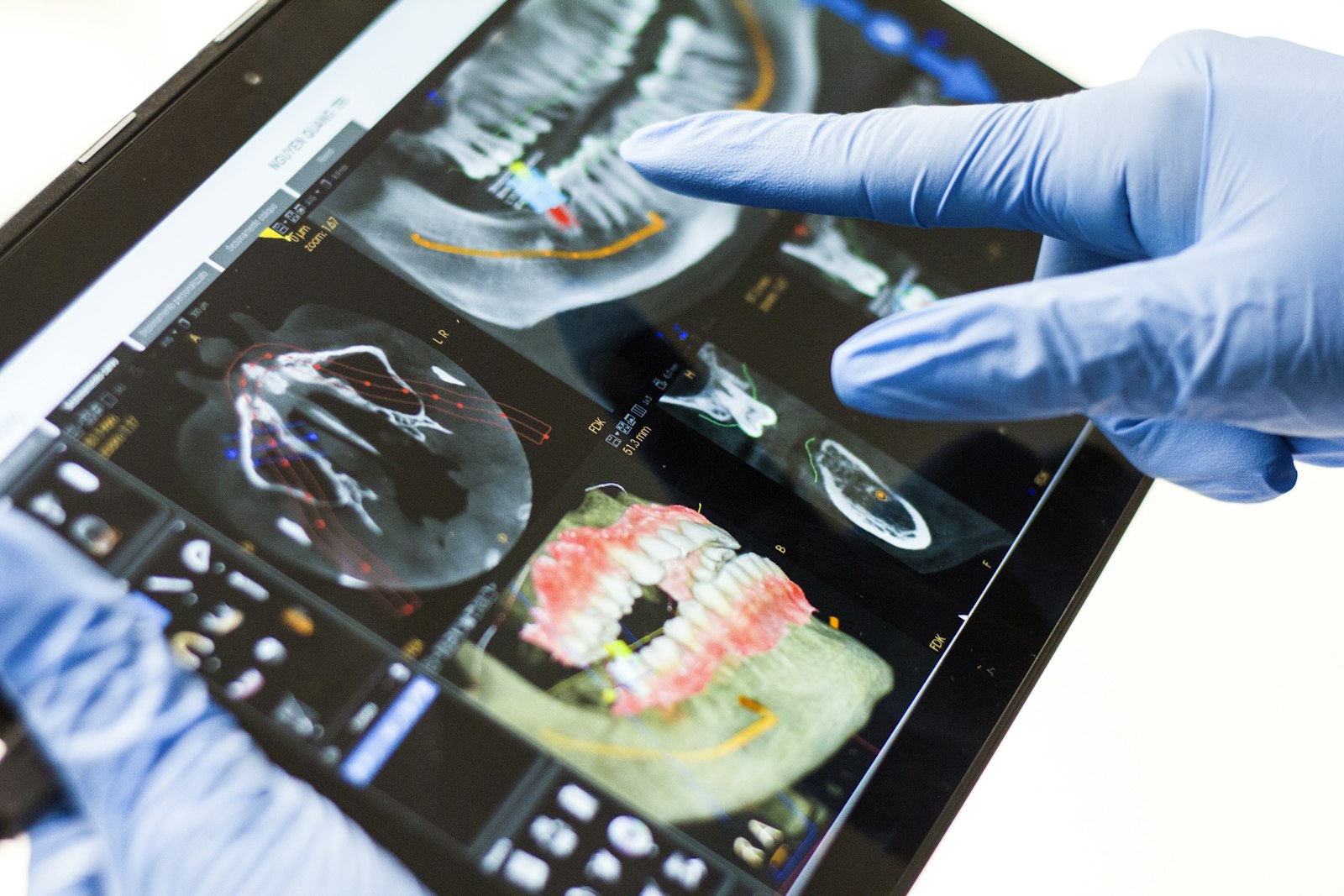 A clinician reviewing a 3D dental scan used to plan an implant
