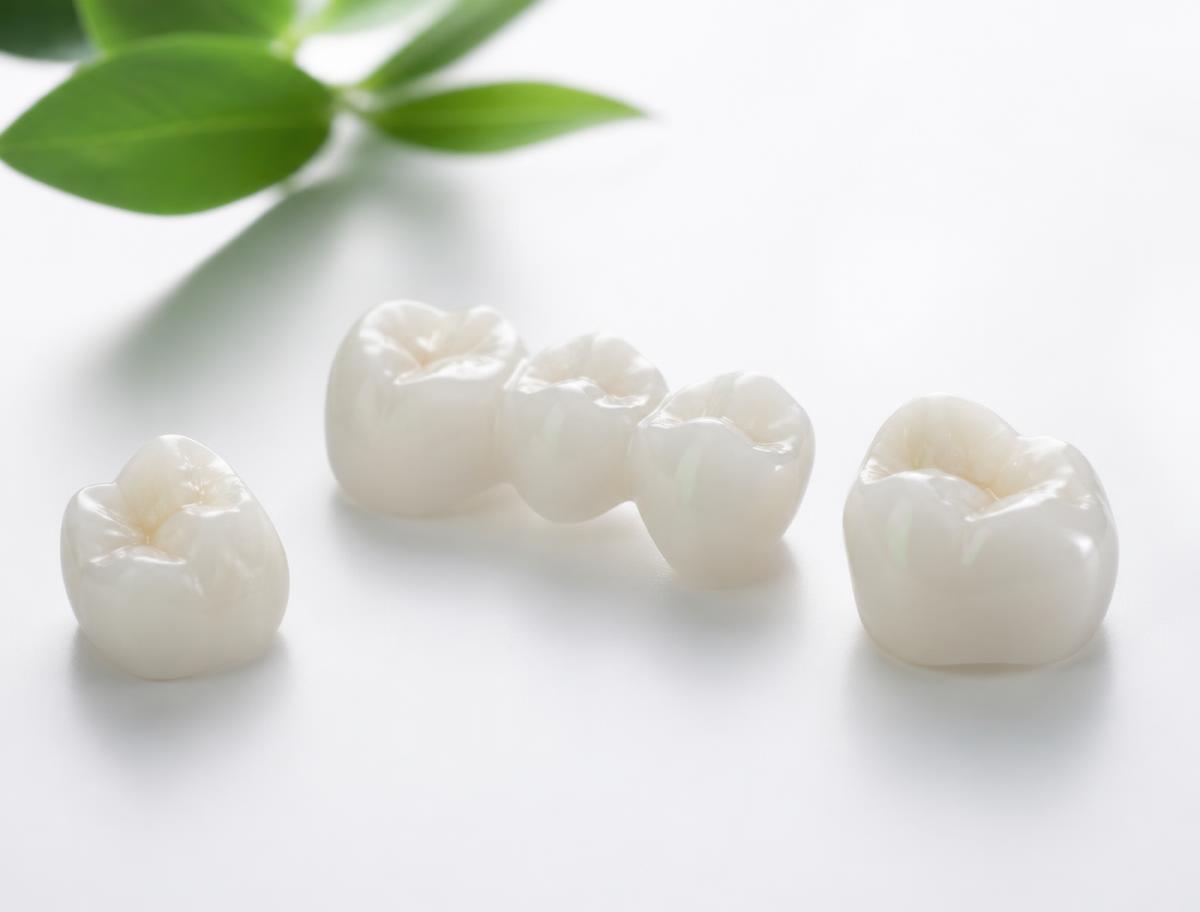 A ceramic dental crown being colour-matched to a patient's smile