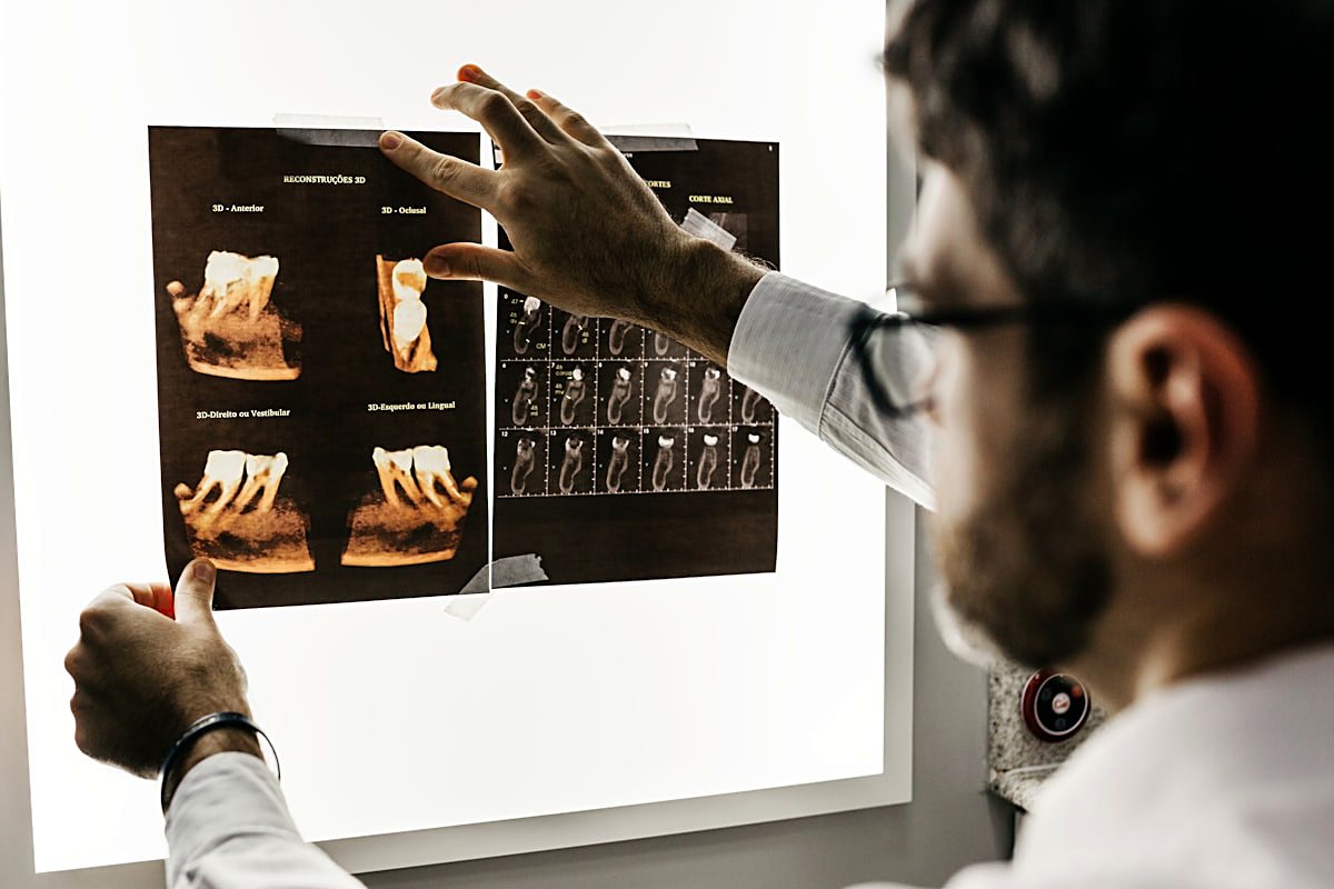 A dentist reviewing dental X-rays on a lightbox
